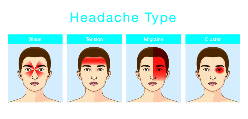 headaches types